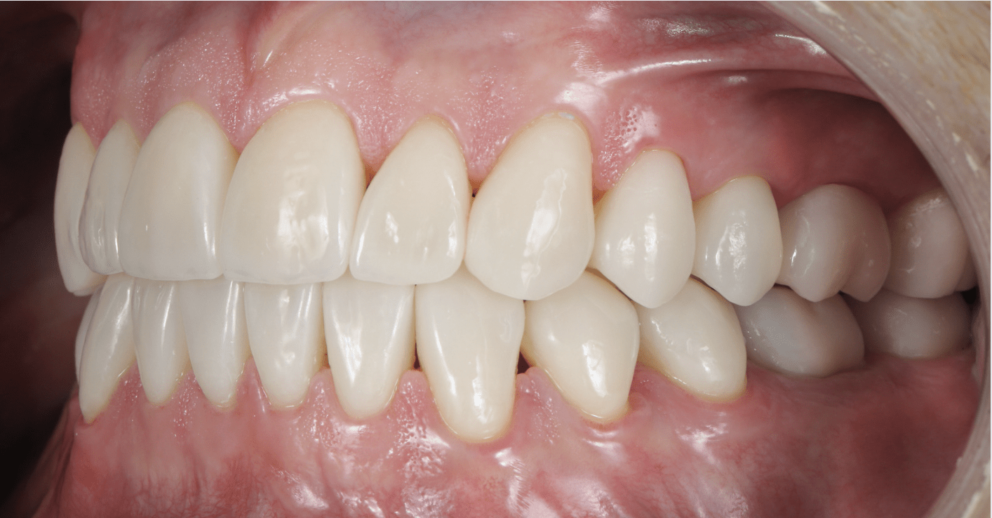 Le Rôle Clé de l'orthodontie